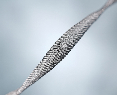 A nitinol self-expanding vascular stent mesh